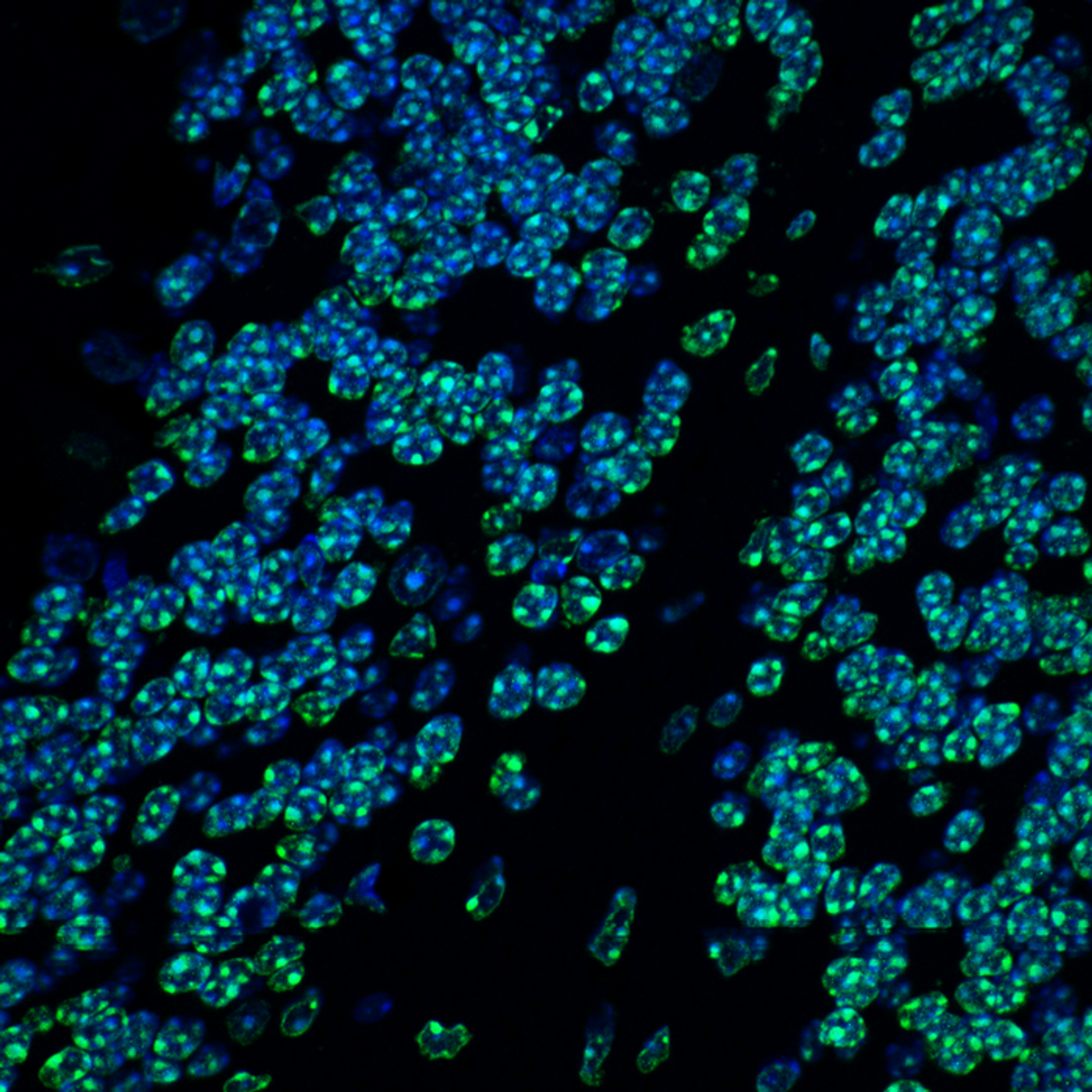 Mouse cerebellum (magnified), DNA (blue), Tri-methylation of lysine 9 on histone H3 (H3K9me3), (green) shows silenced heterochromatin. / Credit: ©Hagelkruys/IMBA