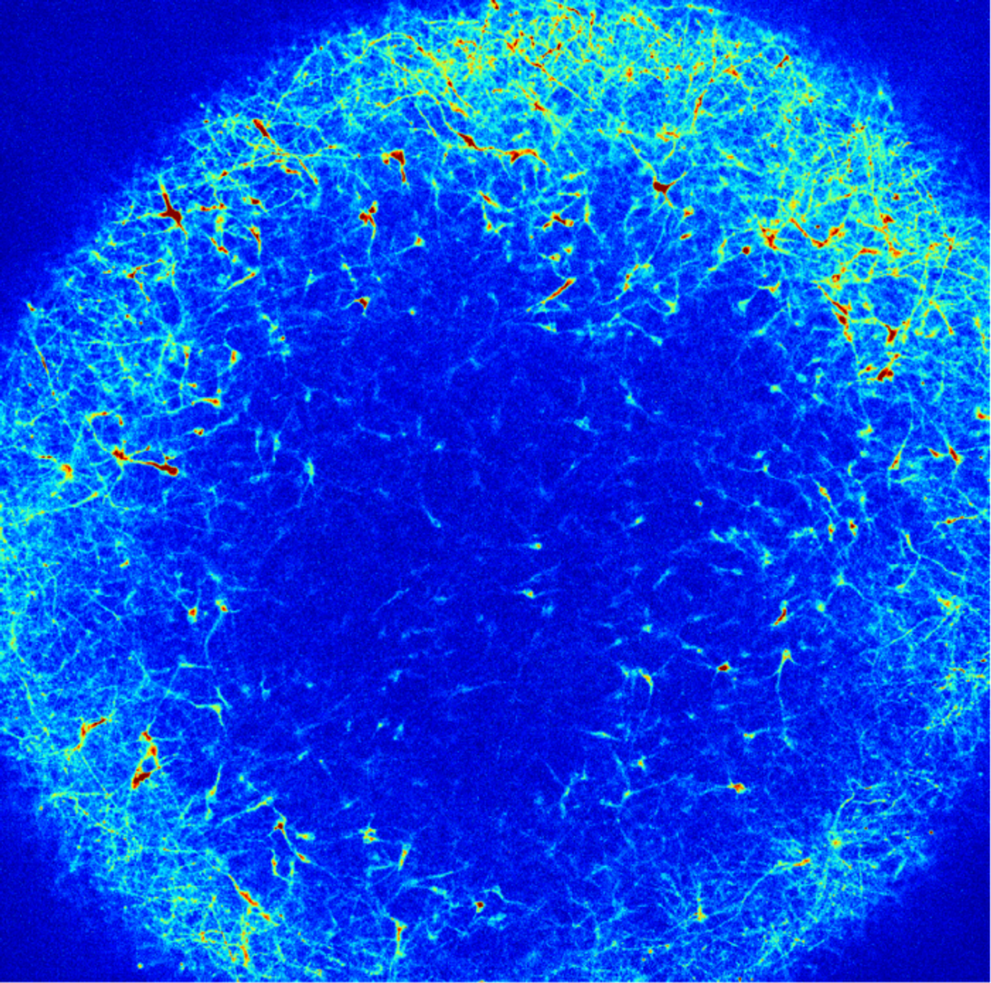 Microscopy image of a brain organoid that shows individual neurons spontaneously firing. / Credit: Paola Arlotta laboratory at Harvard University and Edward Boyden laboratory at MIT/©/All Rights Reserved