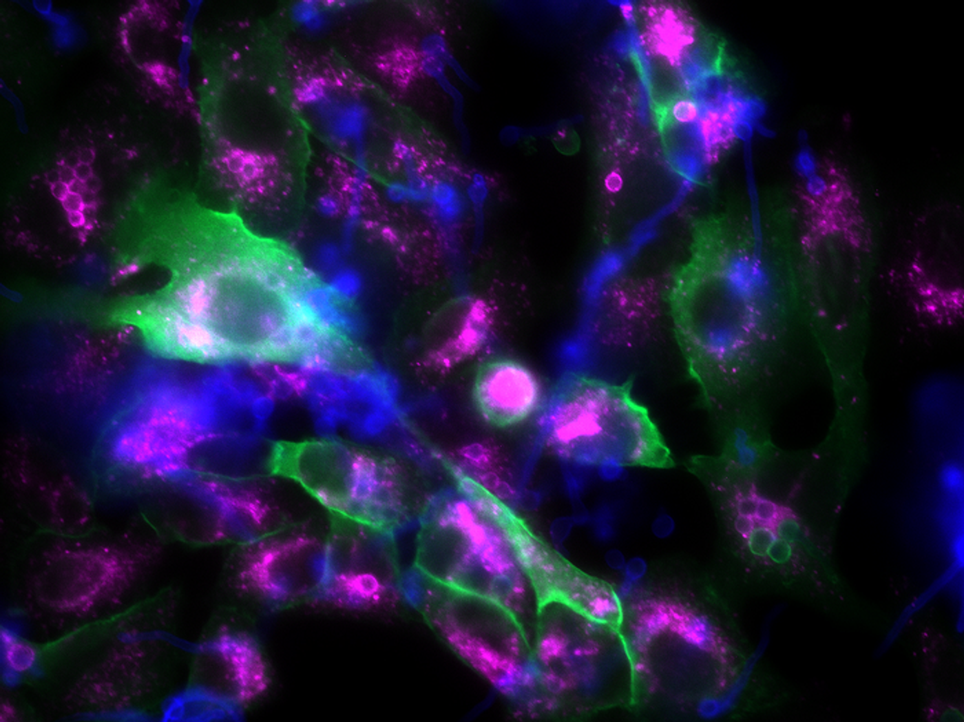 Epithelial cells (large, irregular structures) and fungal spores (small, spherical structures) seen in fluorescence. Fungal spores surrounded by p11 appear green, while mature phagosomes are marked in violet / Image credit: Leijie Jia/Leibniz-HKI