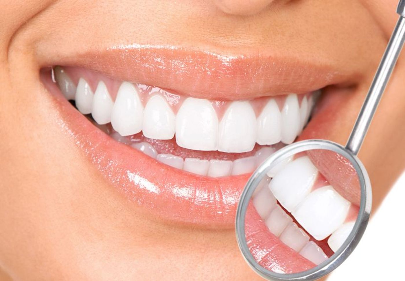 Beneficial bacteria may prevent cavities.