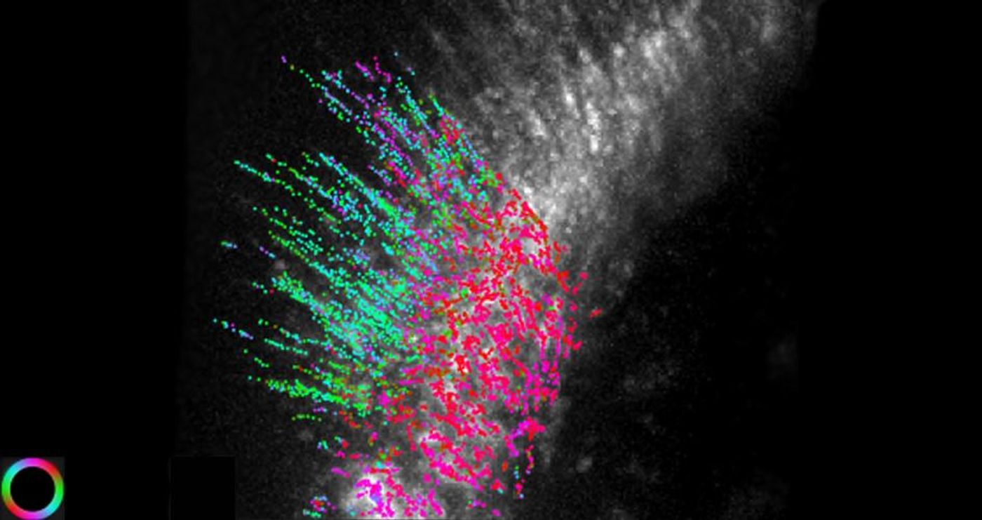 New microscope shows the actin filament orientation in human skin cells, corresponding to the color wheel at bottom left. / Credit: Shalin Mehta and Tomomi Tani