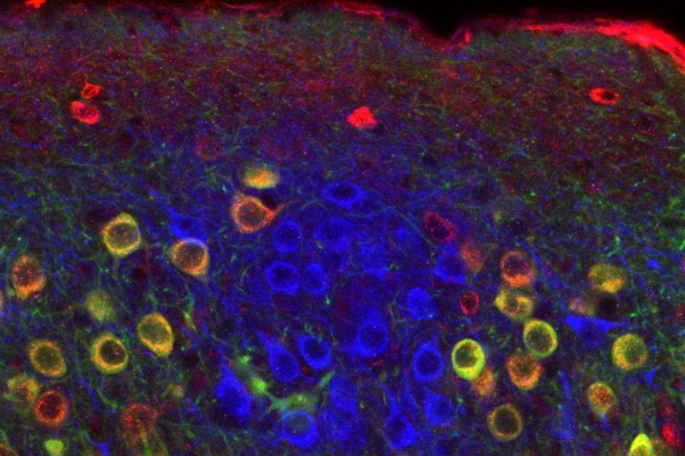 Ocean cells and island cells identified in a new MIT brain study