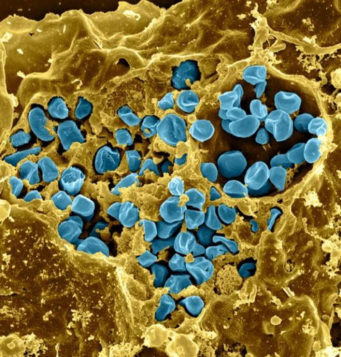 Scanning electron micrograph of a murine macrophage infected with Francisella tularensis strain LVS. Macrophages were dry-fractured by touching the cell surface with cellophane tape after critical point drying to reveal intracellular bacteria. Bacteria (colorized in blue) are located either in the cytosol or within a membrane-bound vacuole. / Credit: NIAID