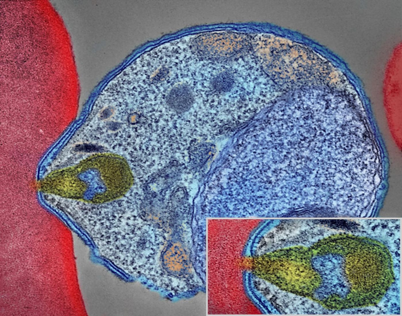 A malaria parasite spot living inside a red blood cell (Wikimedia Common)