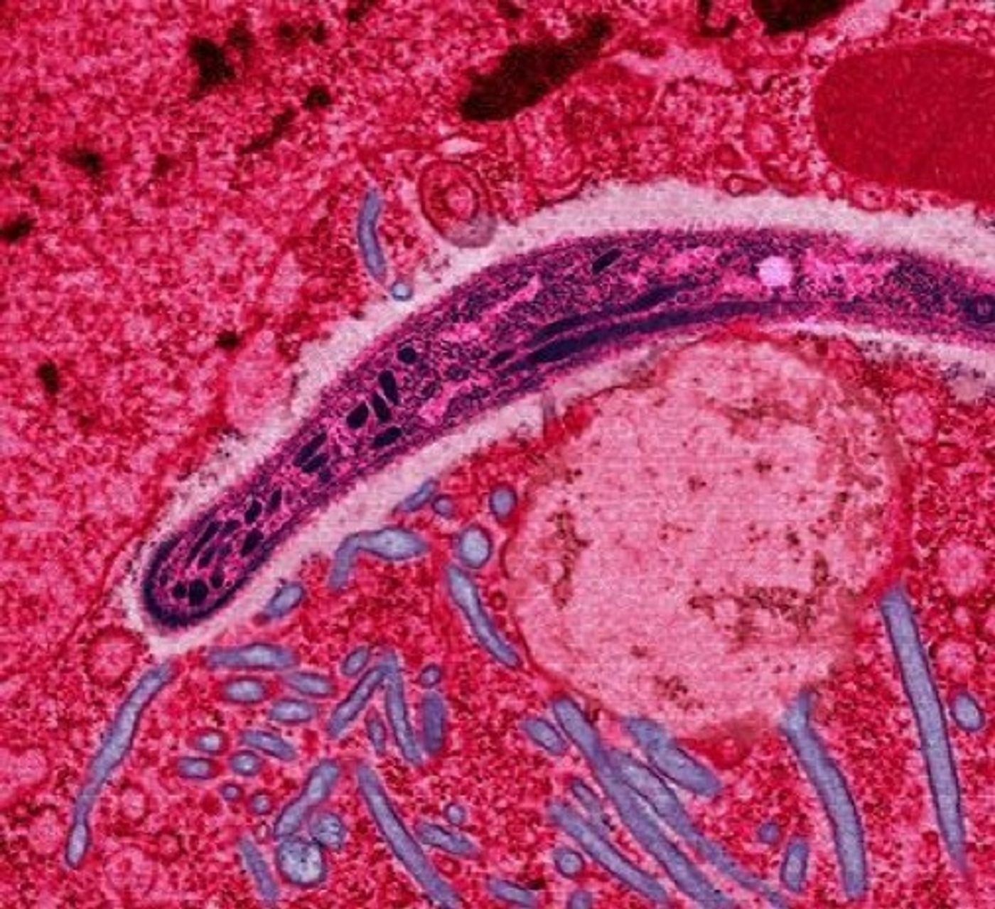 A Plasmodium from the saliva of a female mosquito moving across a mosquito cell / Credit: Wikipedia