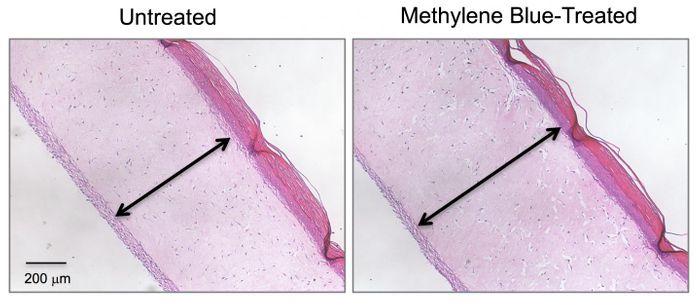 Cross-section images show 3D human skin models made of living skin cells. Untreated model skin (left panel) shows a thinner dermis layer (black arrow) compared with model skin treated with the antioxidant methylene blue (right panel). / Credit: Zheng-Mei Xiong/University of Maryland
