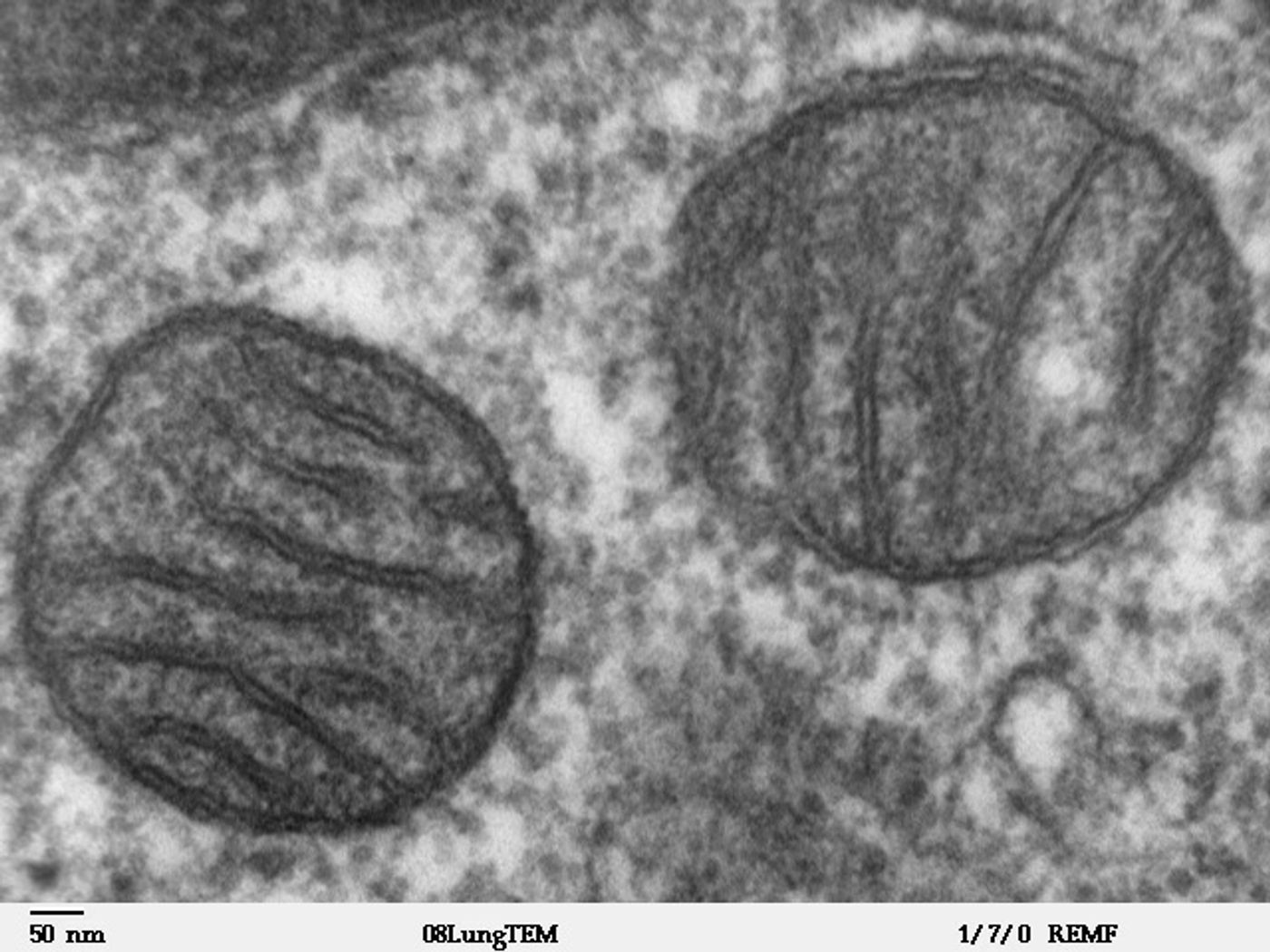 Transmission electron microscope image of mitochondria. Credit: Louisa Howard