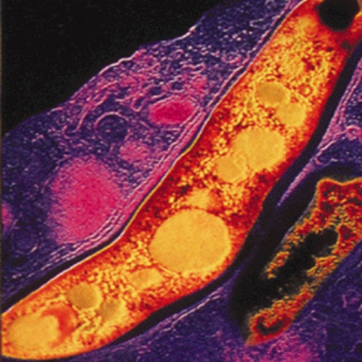 Mycobacterium Tuberculosis