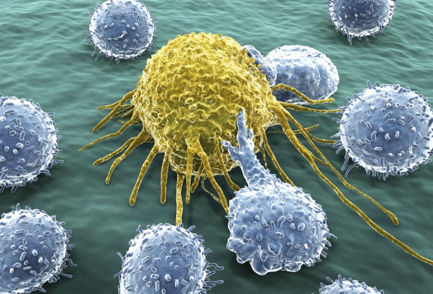 An NK cell attacking a cancer cell