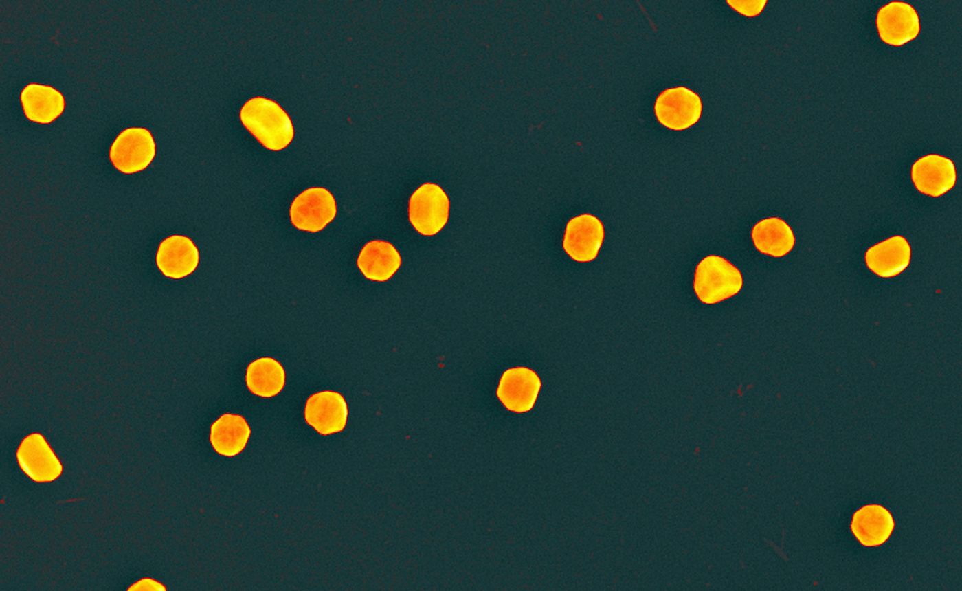 False color scanning electron micrograph (250,000 times magnification) showing the gold nanoparticles created by NIST and the National Cancer Institute's Nanotechnology Characterization Laboratory (NCL) for use as reference standards in biomedical research laboratories. / Credit: Andras Vladar, NIST