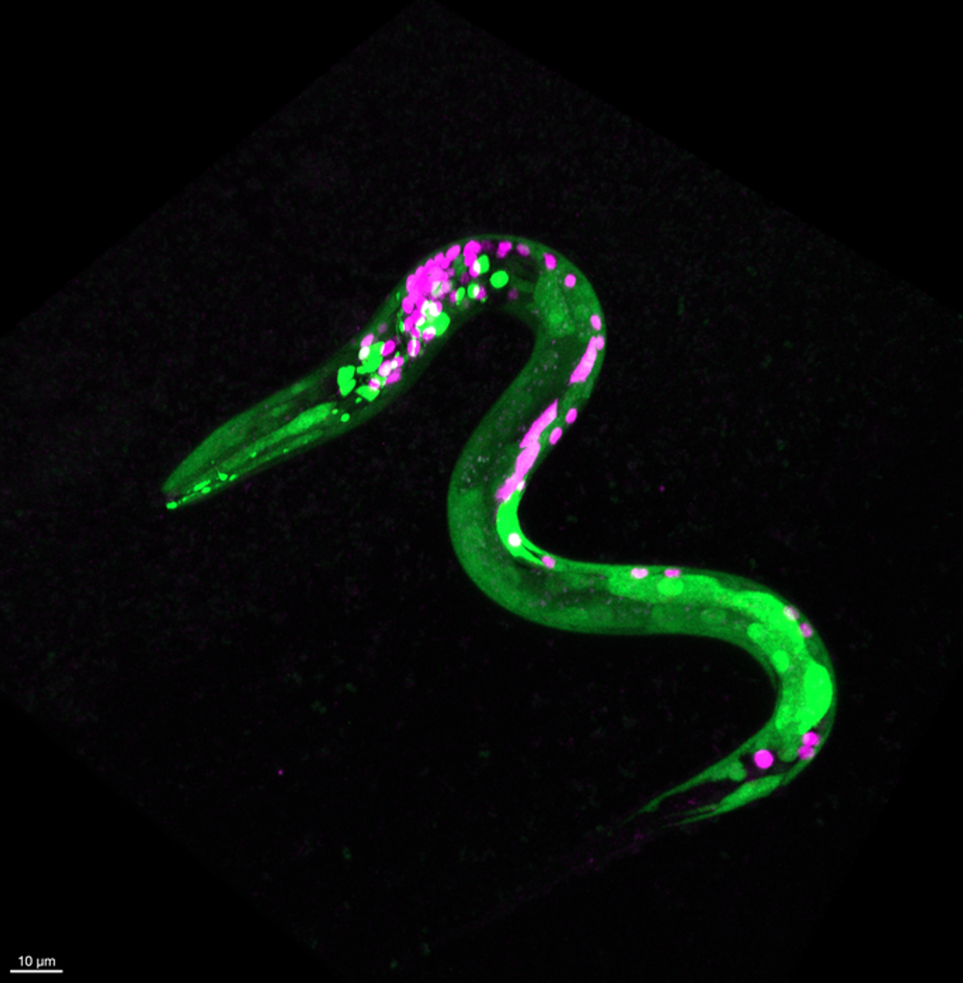 A genetically engineered worm. (Image Credit: Stacy Levichev LICENSE: CC BY-SA)
