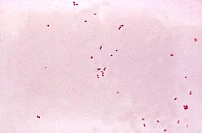 A micrograph of the aerobic Gram-negative Neisseria meningitidis diplococcal bacteria. Credit: שועל