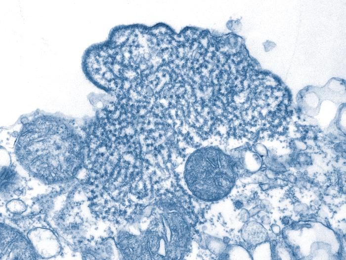 Transmission electron micrograph (TEM) depicted a number of Nipah virus virions that had been isolated from a patient's cerebrospinal fluid (CSF) specimen. / Credit: CDC