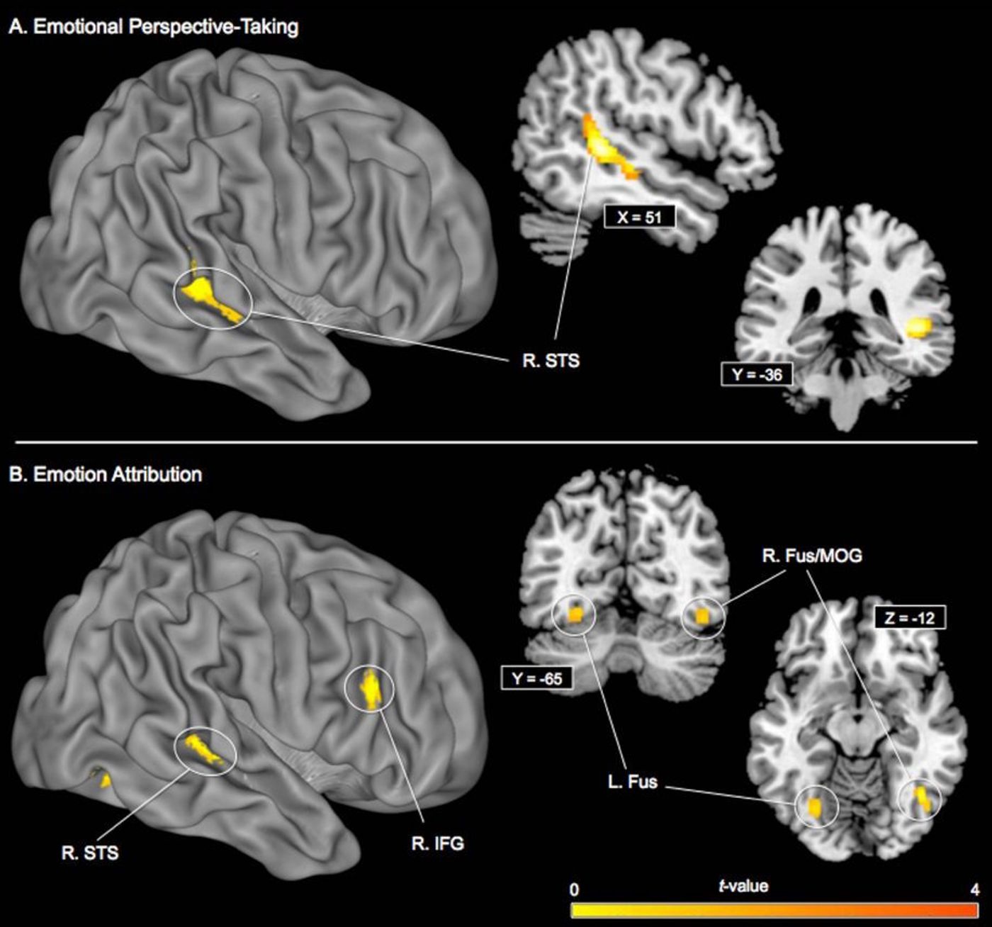 Oxytocin DNA methylation and brain activity during social-cognitive processing (A) emotional perspective-taking (B) emotion attribution. 