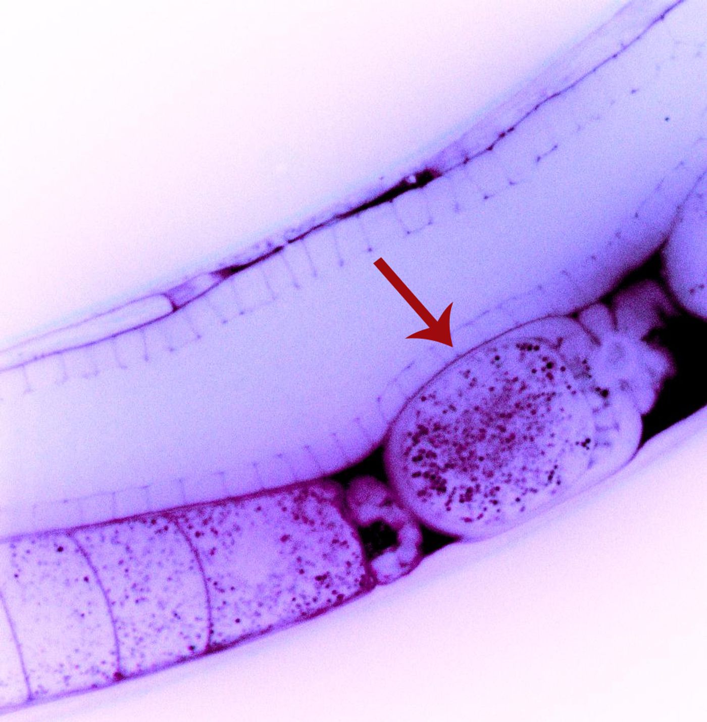 In this image of a roundworm (Caenorhabditis elegans), a recently fertilized egg cell (arrow) contains particles of double-stranded RNA (dsRNA, small magenta dots) that are capable of silencing specific genes. / Credit: Antony Jose