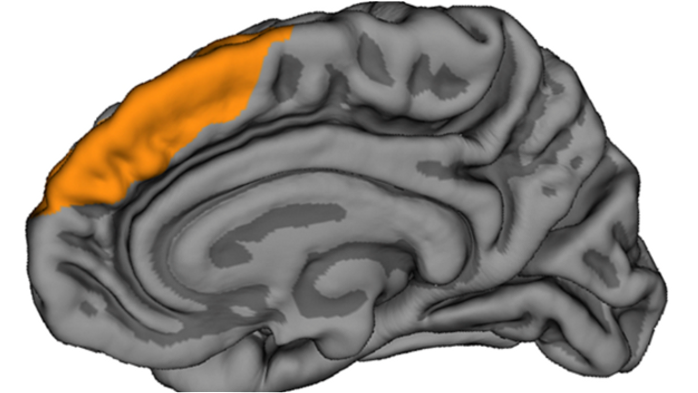 Location of the paracingulate sulcus (yellow) in the brain.