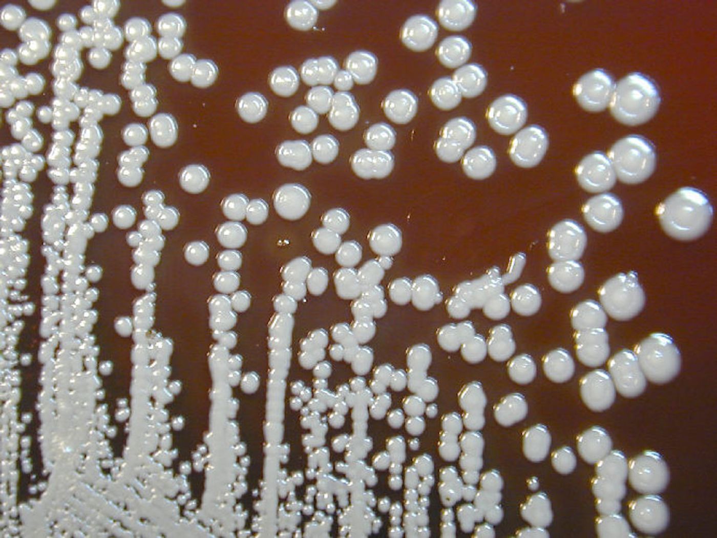 A close view of a bacterial growth culture plate with Burkholderia pseudomallei bacteria colonies 72 hours after inoculation. As incubation is extended, morphology changes. / Credit: CDC/ Courtesy of Larry Stauffer, Oregon State Public Health Laboratory
