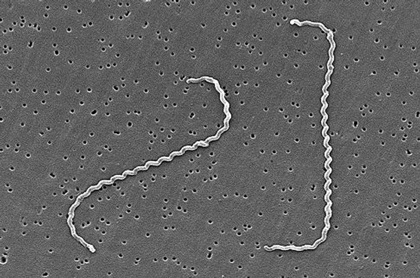 An SEM image revealing some of the ultrastructural features of two, spiral-shaped, Leptospira interrogans bacteria bound to a 0.2 µm filter. / Credit: CDC/ Rob Weyant