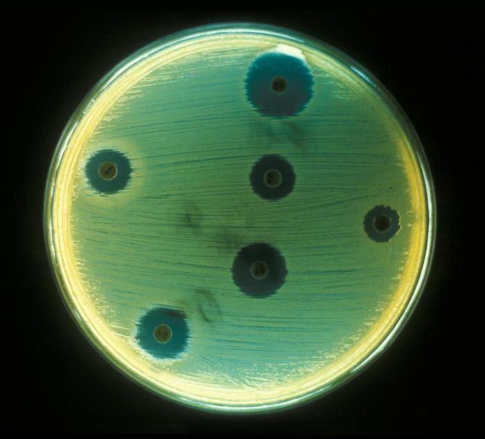  A Petri dish inoculated with Staphylococcus aureus for an antimicrobial sensitivity test / Credit: CDC/Don Stalons