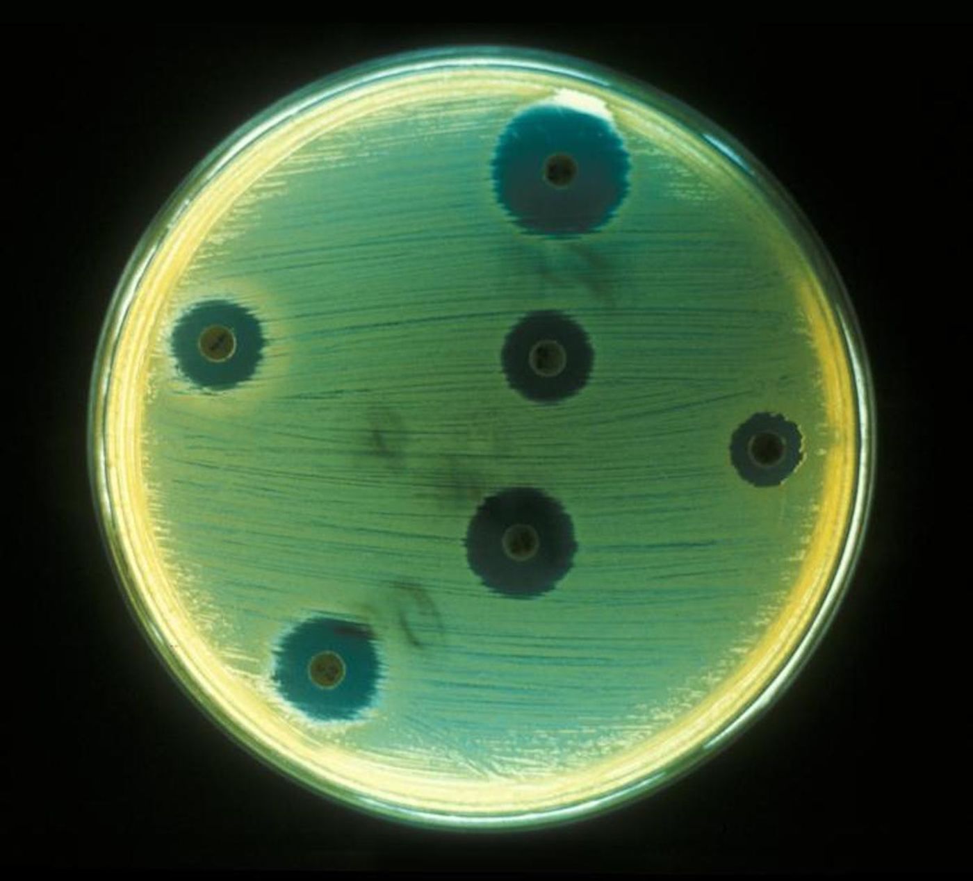  A Petri dish inoculated with Staphylococcus aureus for an antimicrobial sensitivity test / Credit: CDC/Don Stalons