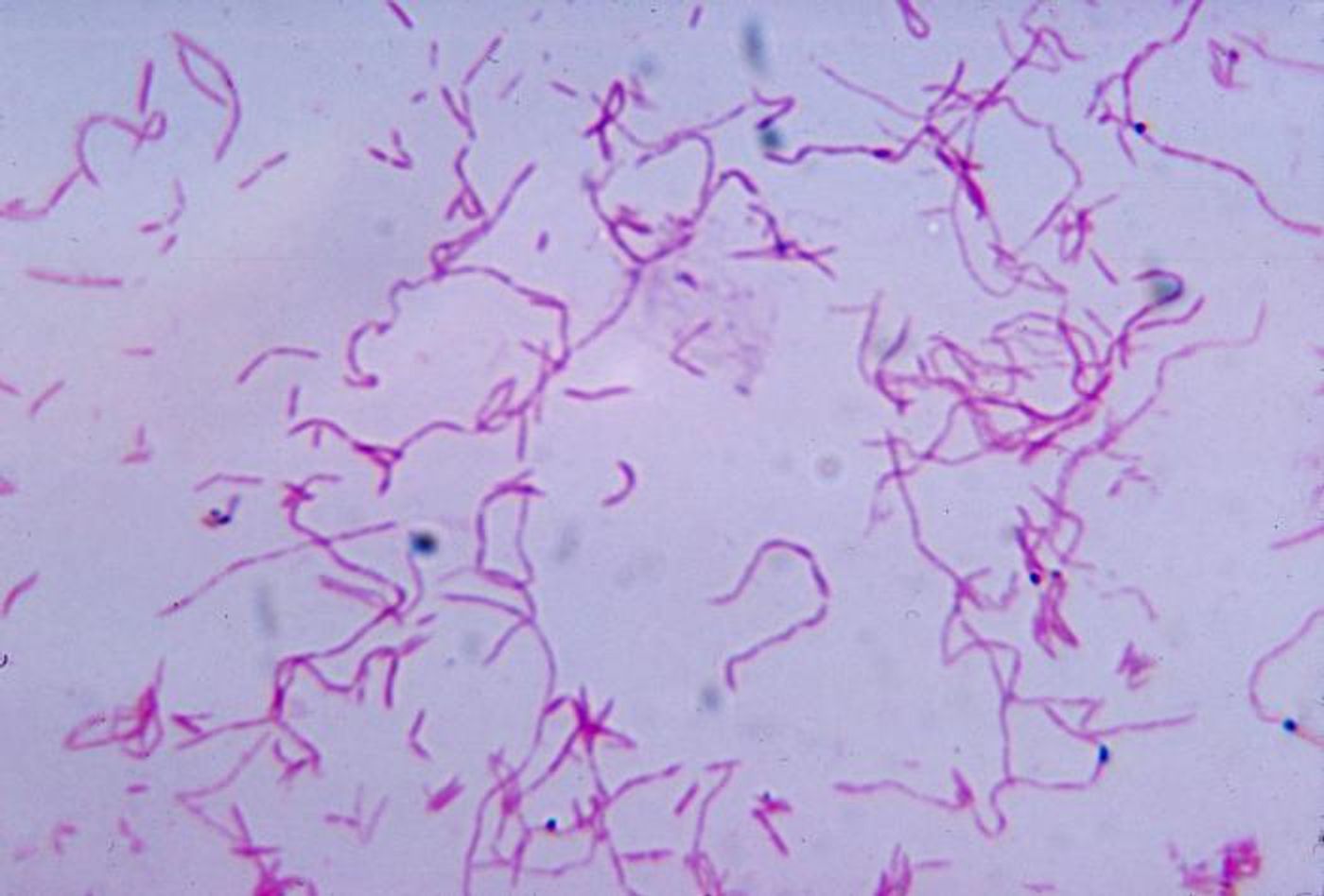 Fusobacterium nucleatum / Credit: Centers for Disease Control and Prevention