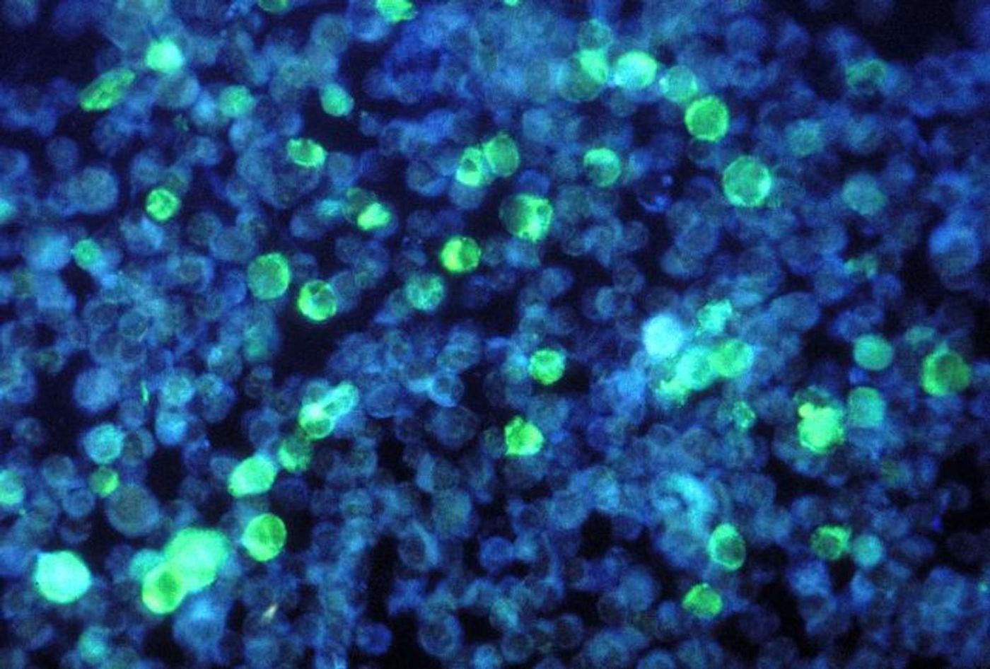 Leukemia cells that contain Epstein-Barr virus (EBV); infected cells are green. EBV, one of the most common human viruses, is a member of the Herpesvirus family. / Credit: CDC/ Dr. Paul M. Feorino