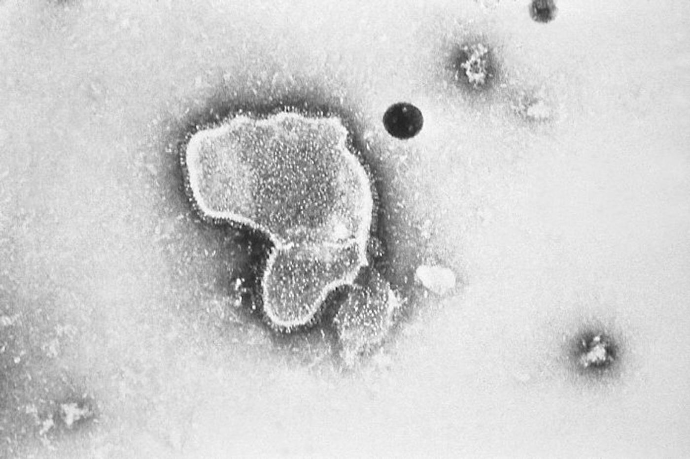 A TEM image of human respiratory syncytial virus (RSV) / Credit: Centers for Disease Control and Prevention/ E. L. Palmer