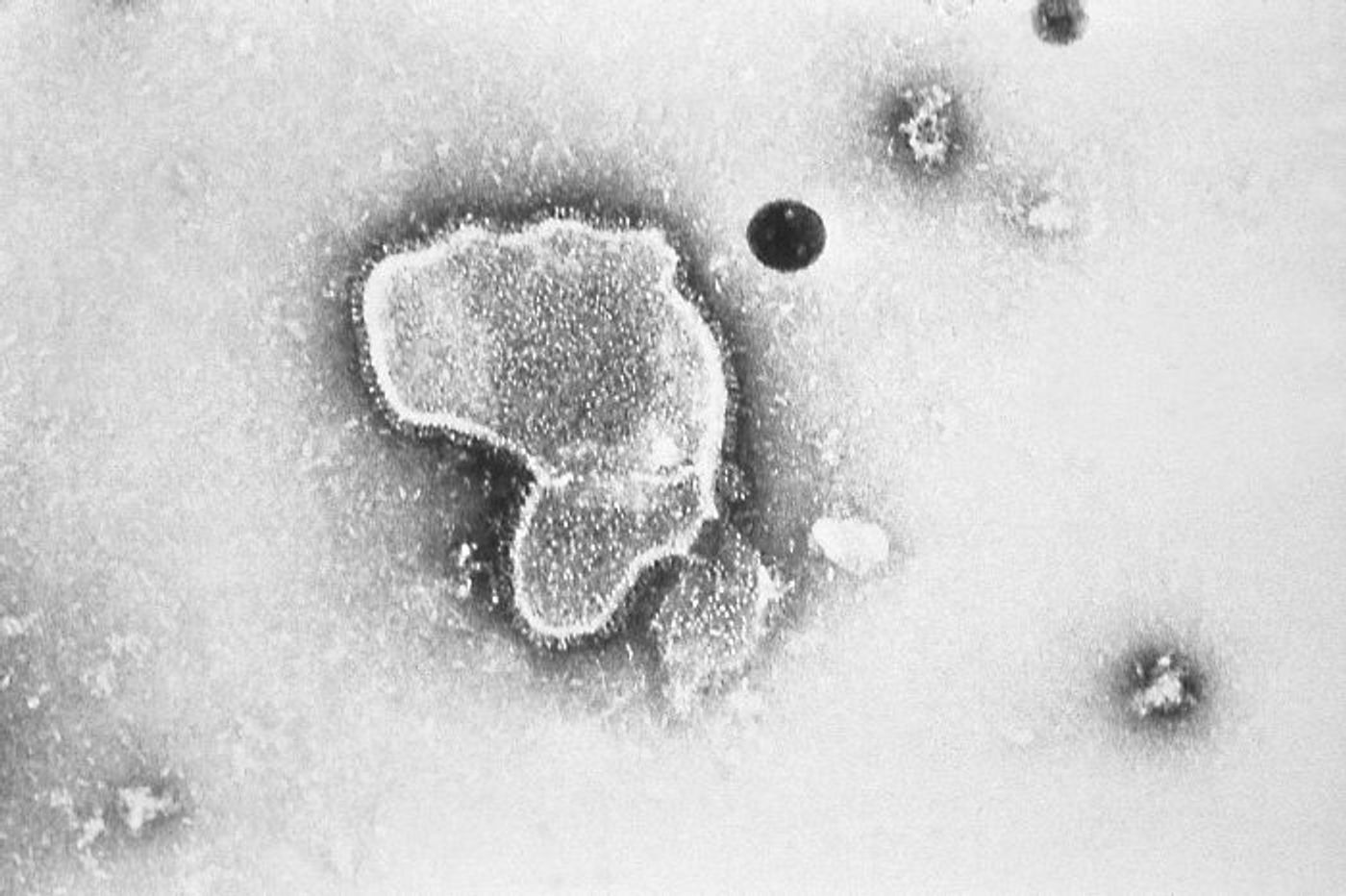 A TEM image of human respiratory syncytial virus (RSV)  / Credit: CDC/ E. L. Palmer