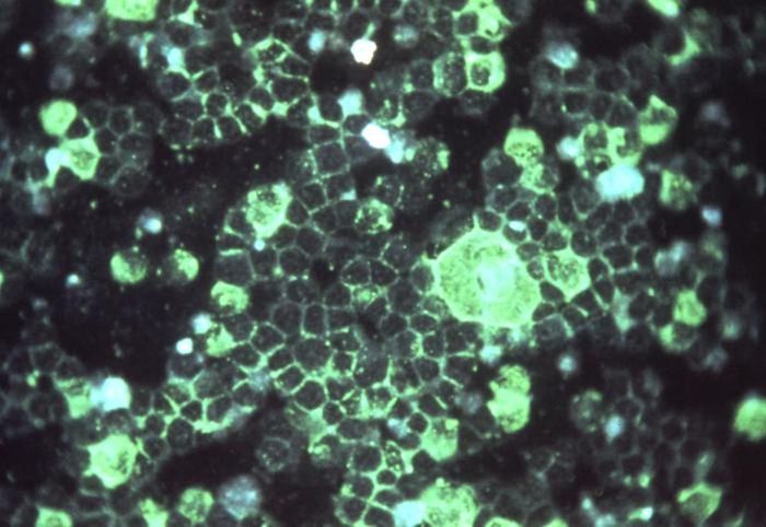 A photomicrograph of respiratory syncytial virus (RSV) in an unidentified tissue sample / Credit: CDC/ Dr. Craig Lyerla