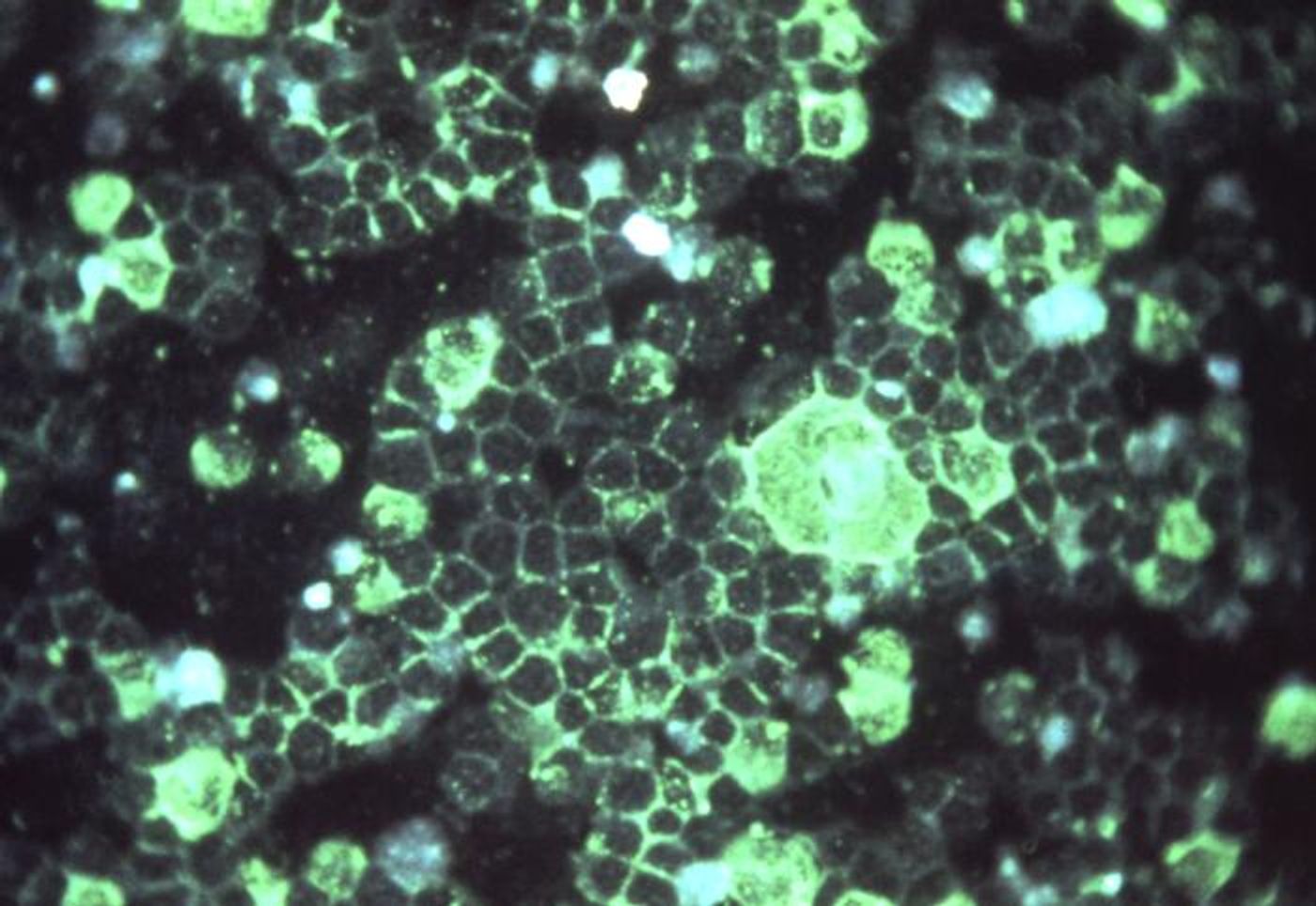 Respiratory syncytial virus (RSV) is seen in a tissue sample. / Credit: CDC/ Dr. Craig Lyerla