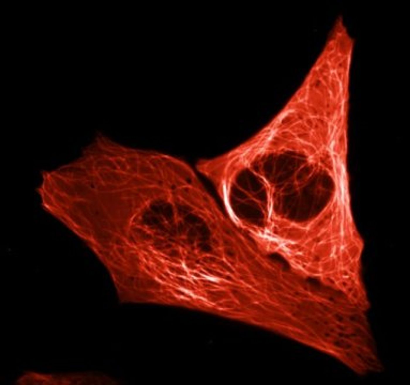 The microtubule cytoskeleton in mScarlet. These are protein fibers and enable transport within the cell. / Credit: Captured by: Lindsay Haarbosch, MSc, UvA