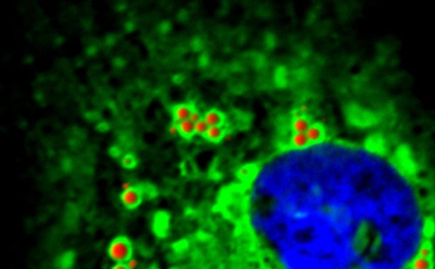 RNA molecules of the hepatitis C virus carrying the N6-methyladenosine chemical tag interact with proteins that bind to this tag (green) at sites in the cells (red) that are known for virus assembly./ Credit: Nandan S. Gokhale