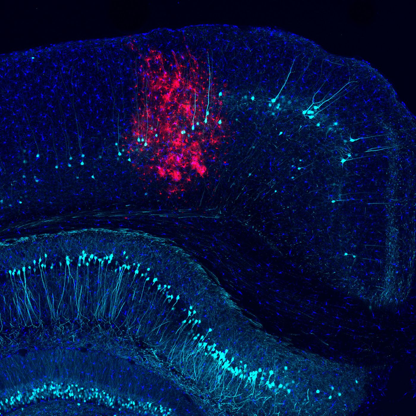 In the cortex of a mouse, adenovirus-transduced cells (red) appear among labeled microglia (dark blue) and subsets of neurons (light blue) / Credit: Salk Institute