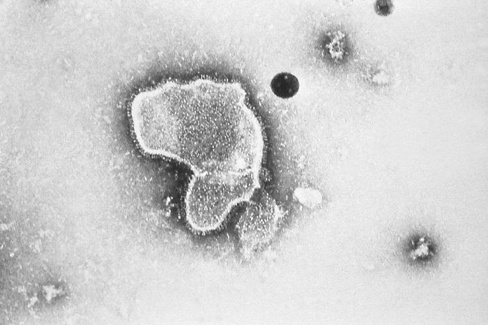 In their study, researchers used Respiratory Syncytial Virus (pictured) and the Sendai virus, also known as murine parainfluenza virus type 1, is an RNA virus not pathogenic to humans. It was first isolated in the 1950s in Japan and has been used ever since as a tool in the research lab.