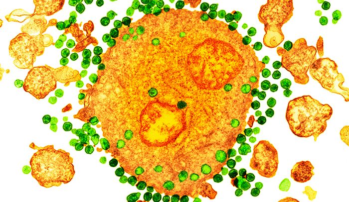 Working in a monkey model of HIV, scientists discovered that a dual-antibody therapy can boost the immune system to control the infection and prevent the virus from returning. Credit: Rockefeller University