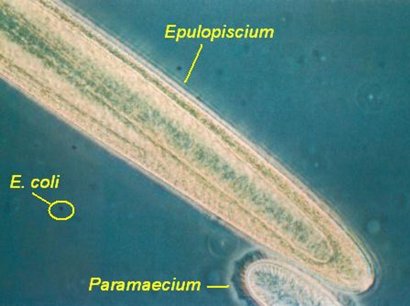 Epulopiscium dwarfs this E. coli cell.