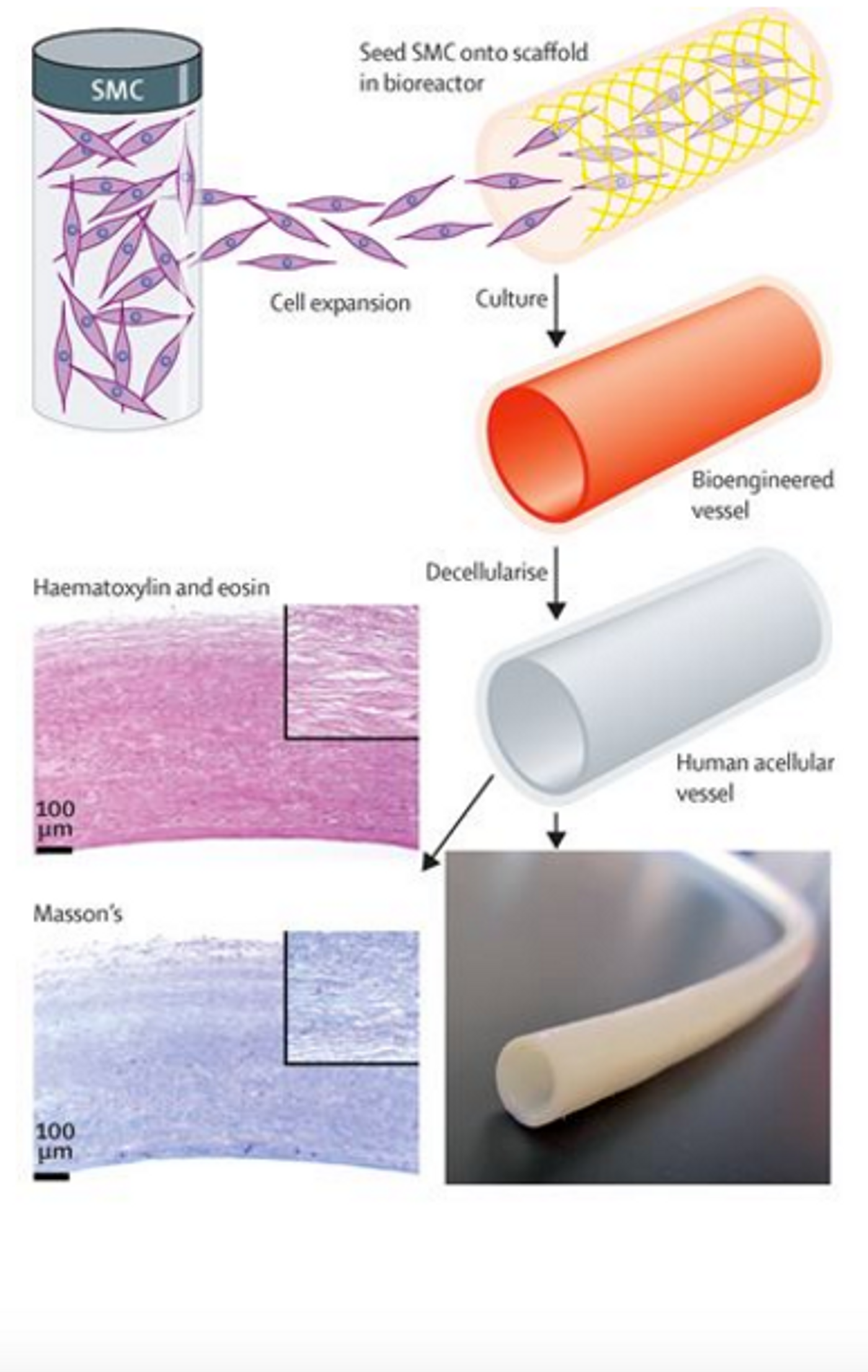 Staining confirms that the engineered blood vessel is acellular.