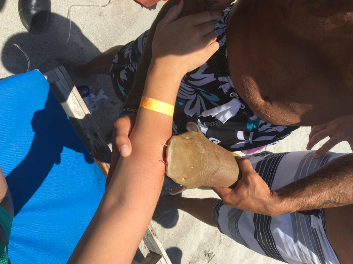 A baby nurse shark locked itself to a female beach-goer's arm and refused to let go.