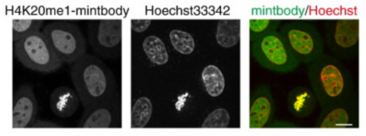 The localization of H4K20me1-mintbodies in living cells. / Credit: Journal of Molecular Biology Sato et al