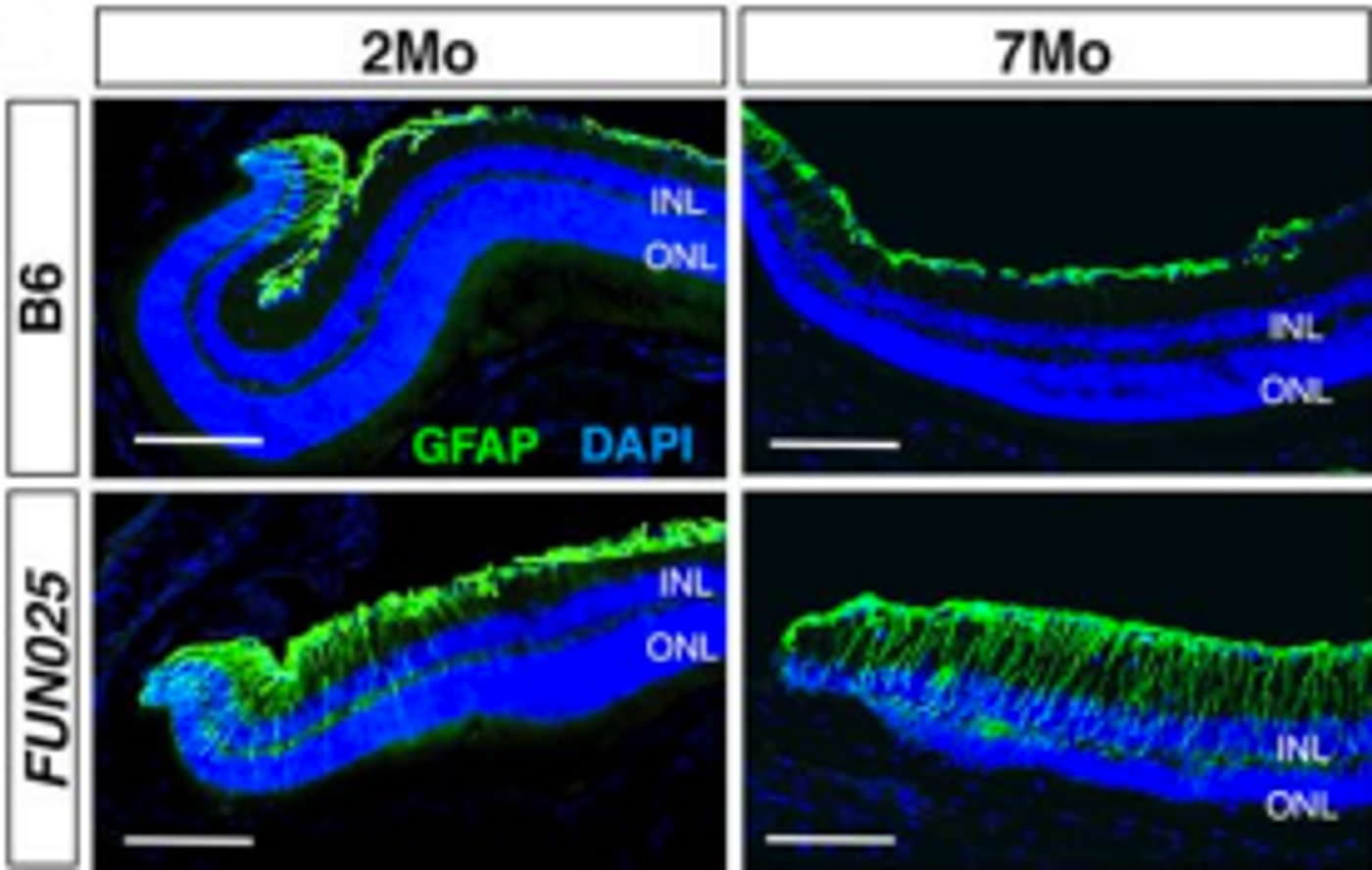 Age-dependent retinal abnormalities in FUN025 mice - the research model - are shown here / Credit: eLife Lee et al