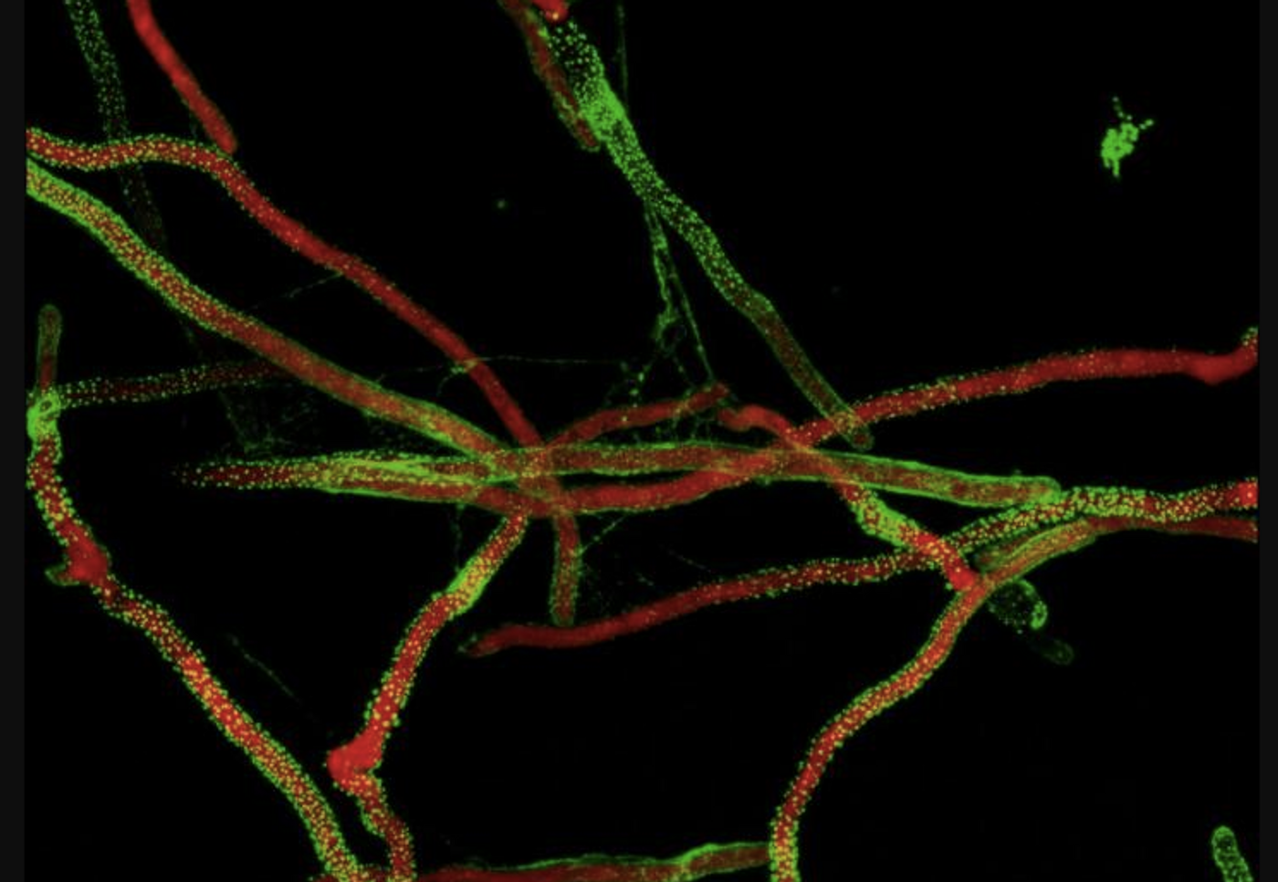 The fungus Aspergillus fumigatus (in red) produces a sticky sugar molecule (in green) to make a biofilm that is important for its virulence. It covers the fungus and allows it to stick to surfaces and tissues, making it difficult to remove and treat patients. Researchers developed a new innovative technique aimed at destroying biofilms. / Credit: Brendan Snarr, McGill University Health Centre