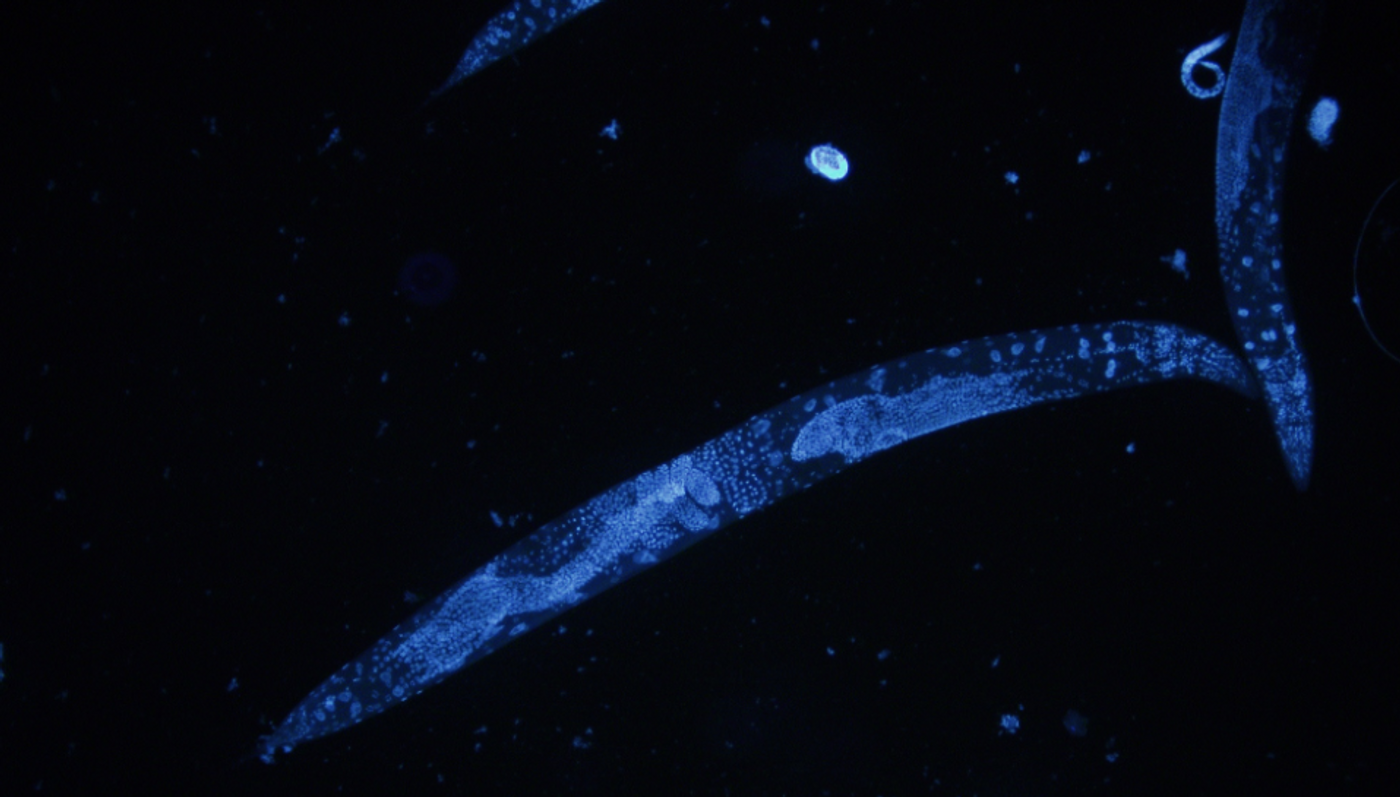 C. elegans stained with DAPI / Credit: Wikimedia Commons