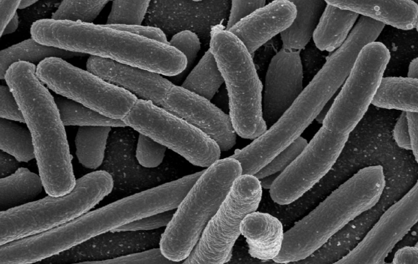 Escherichia coli, one of the many species of bacteria present in the human gut / Credit: Rocky Mountain Laboratories, NIAID, NIH - NIAID