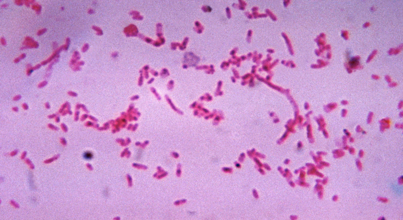 From the Fusobacterium family: Fusobacterium novum after being cultured in a thioglycollate medium. / Credit: CDC