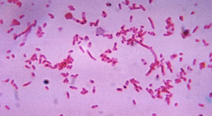 From the Fusobacterium family: Fusobacterium novum after being cultured in a thioglycollate medium. / Credit: CDC
