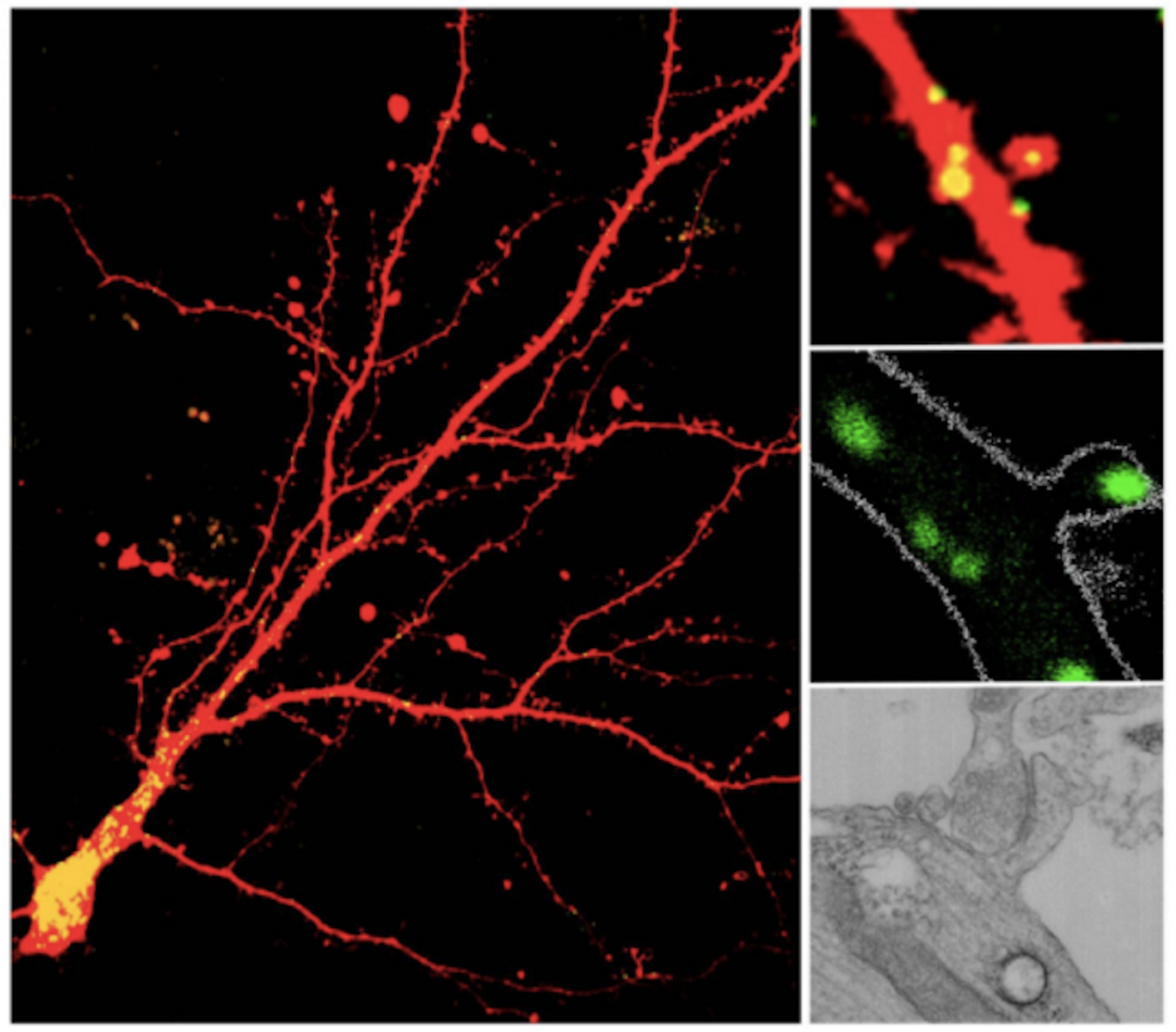 Lysosomes were identified in dendrites and dendritic spines using various techniques. Cultured neurons show lysosomes throughout neurons and in dendritic spines indicated in yellow (left and upper right); brain slices show a lysosome in the head of the spine highlighted in green (middle right); and transmission electron microscopy reveals a lysosome (black circle) near the base of a spine (bottom right). / Credit: Marisa Goo, Gentry Patrick/UCSD/Journal of Cell Biology