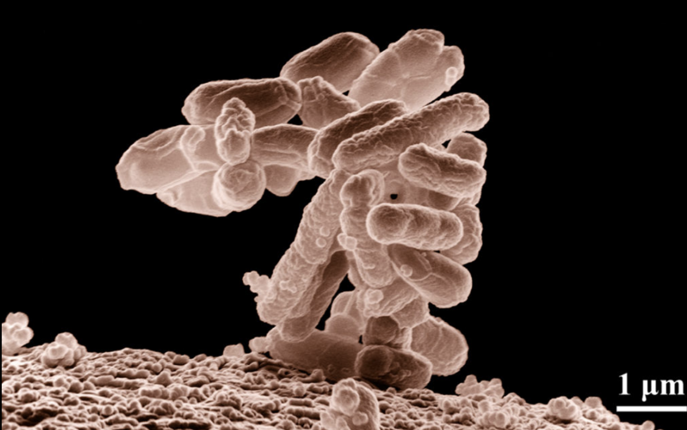 ow-temperature electron micrograph of a cluster of E. coli bacteria (a common intestinal bacterium), magnified 10,000 times. Each individual bacterium is oblong shaped./ Credit: United States Department of Agriculture.
