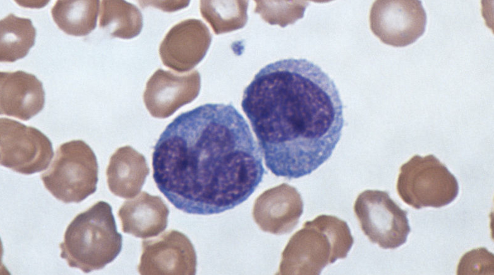 A micrograph of monocytes, the cell type used for this work. / Credit: Wikimedia Commons