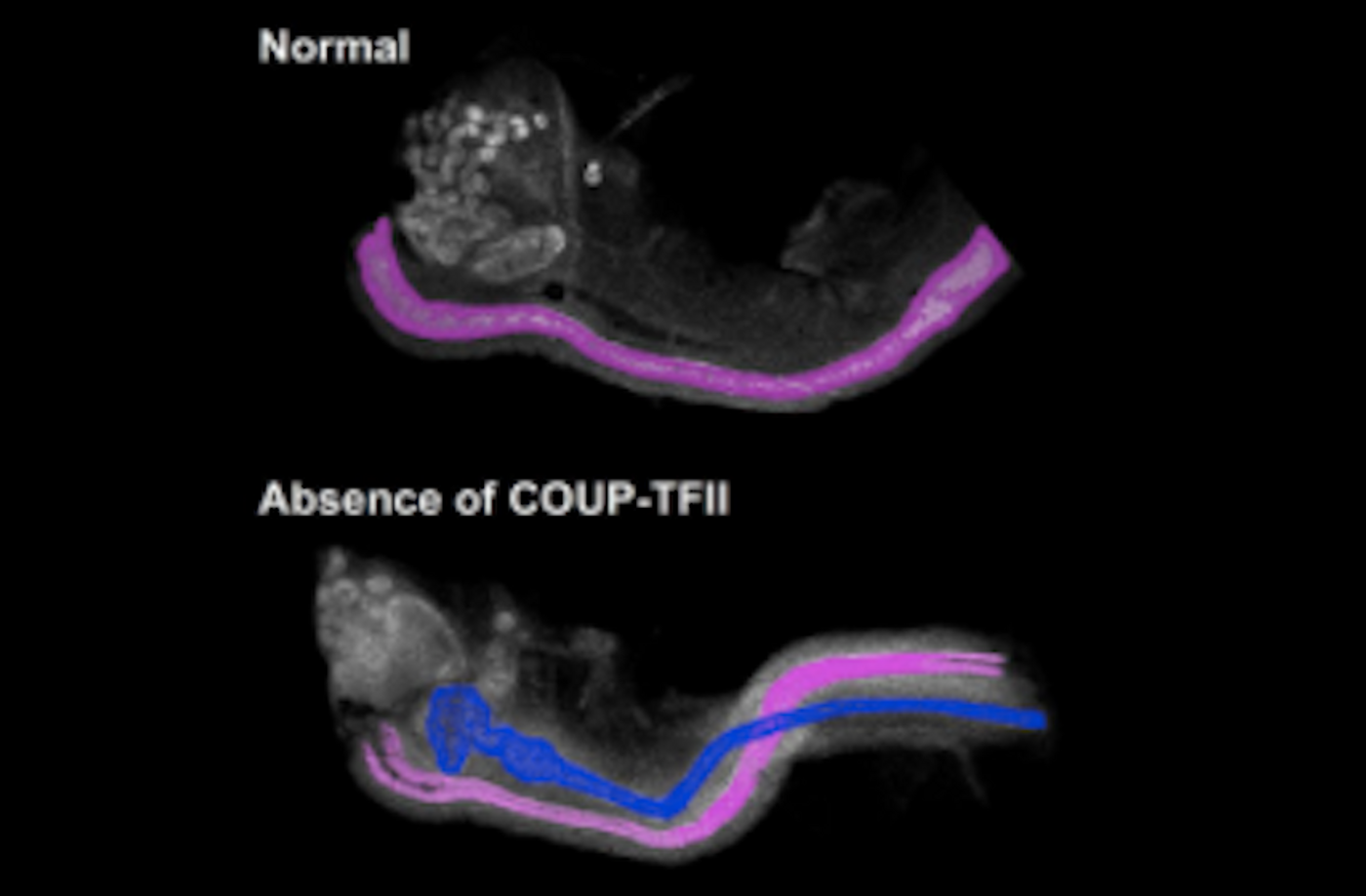 The normal female mouse embryo (top) contains only the female reproductive tract, highlighted in pink. The female mouse embryo without COUP-TFII (bottom) has both male, in blue, and female reproductive tracts. / Credit: NIEHS