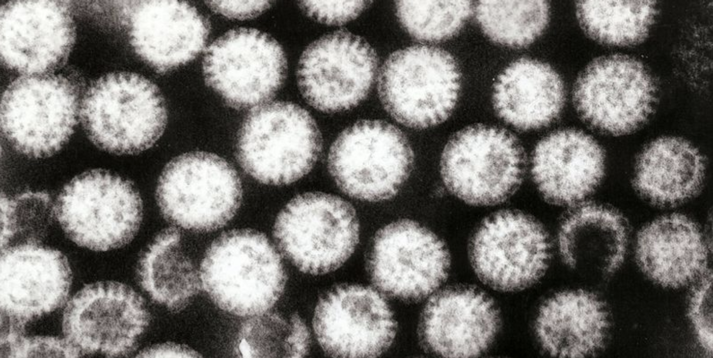 Transmission electron micrograph of multiple rotavirus particles. Each one is about 70 nanometers in meter / Credit: Wikipedia/Dr Graham Beards